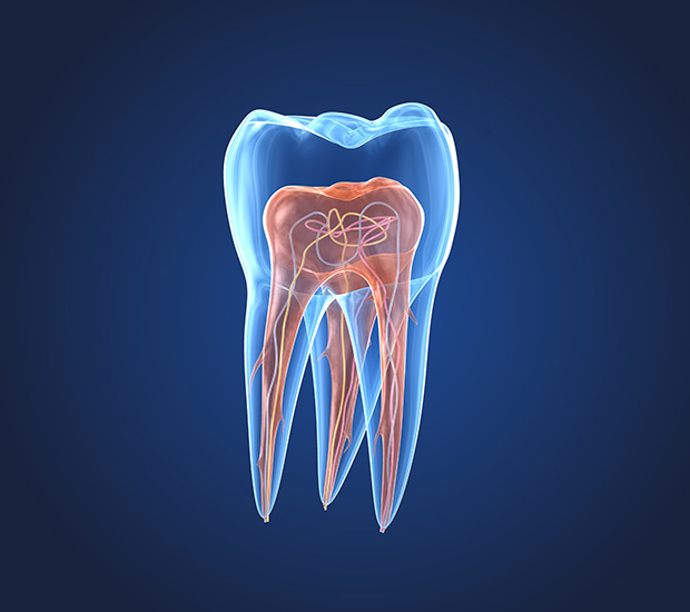 Saginaw What is an Endodontist